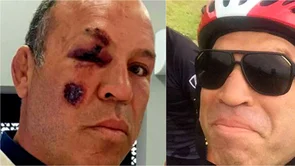 Wanderlei Silva ponovno je ozlijeđen u prometnoj nesreći
